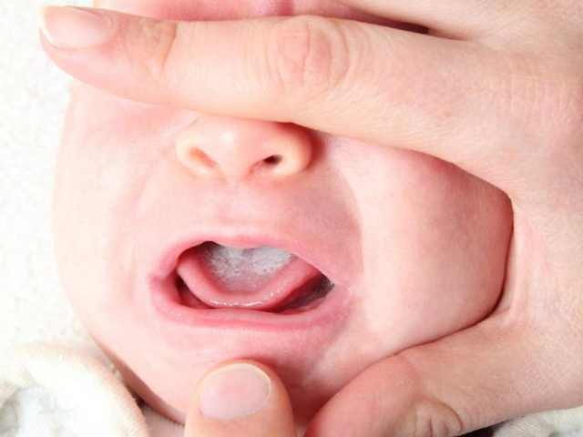 Температура у ребенка и запах изо рта налет на языке